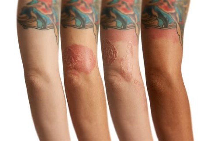 Can I get a tattoo after Covid?