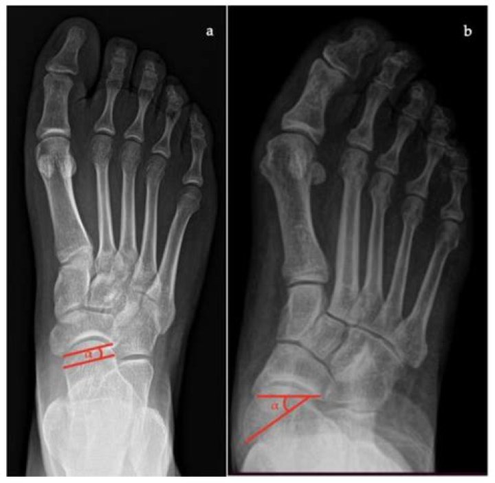Dave Chappelle Height: Uncovering The Comedian's Vertical Measurements