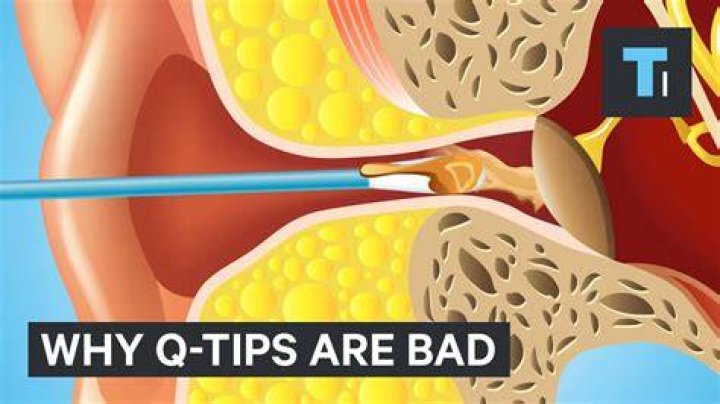 Do Q Tips hurt your ears?