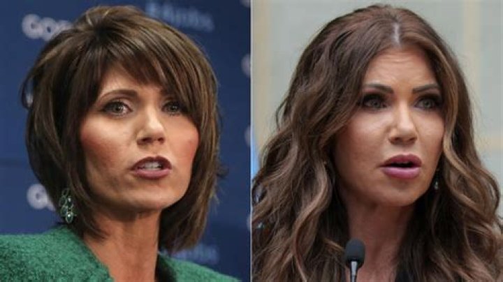 Get The Scoop: Kristi Noem's Plastic Surgery Journey Unveiled
