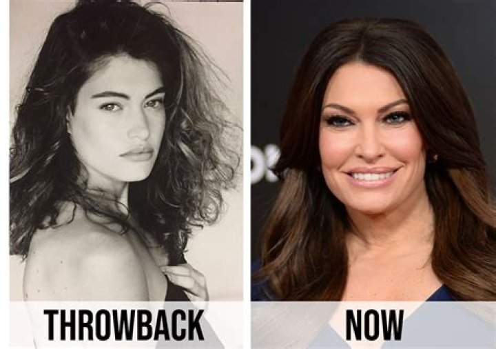 Kimberly Guilfoyle's Plastic Surgery Journey