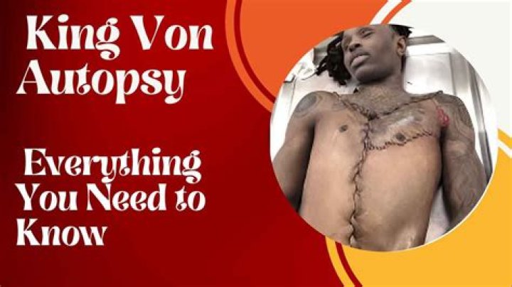 King Von's Autopsy Report: A Comprehensive Examination