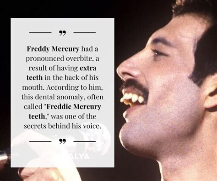 Unveiling The Untold Truths: Discoveries About Freddie Mercury's Family