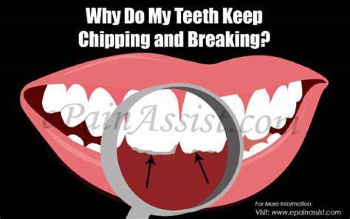 Why do my teeth keep breaking?