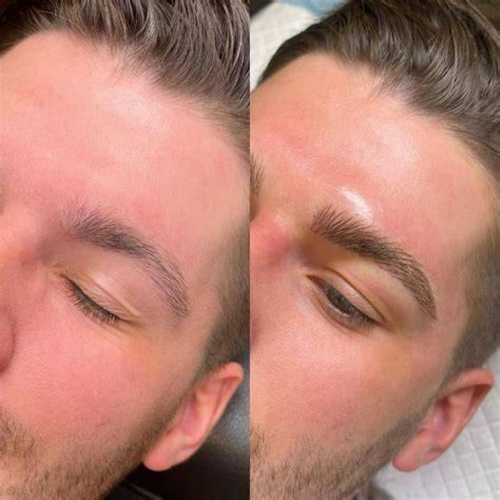 Will I lose my eyebrows during chemo?